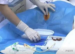 国产女王导尿视频,医疗护理的温情与挑战